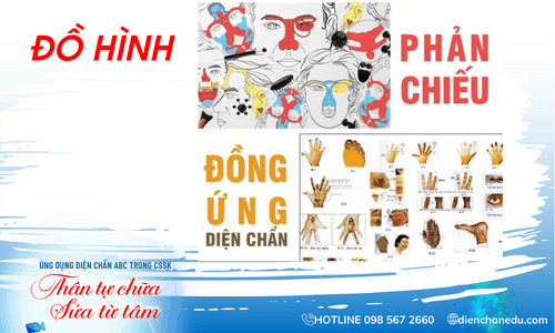 ĐỒ H&Igrave;NH ĐỒNG ỨNG DIỆN CHẨN ĐIỀU KHIỂN LIỆU PH&Aacute;P